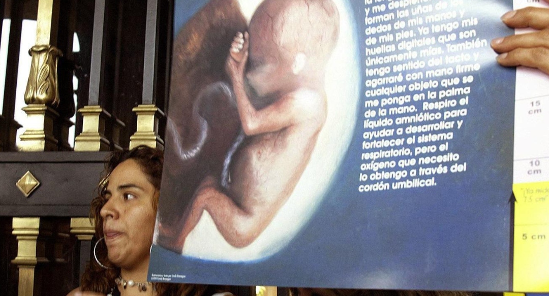 Protesta contra el aborto