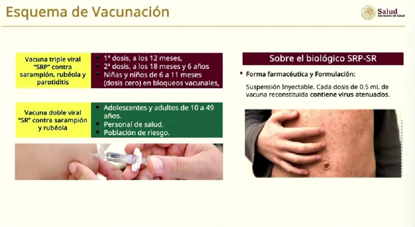 Sarampión