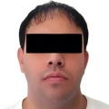 José Juan "N"