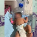 La historia del bebé que usó una botella como respirador en Tabasco a falta de insumos médicos